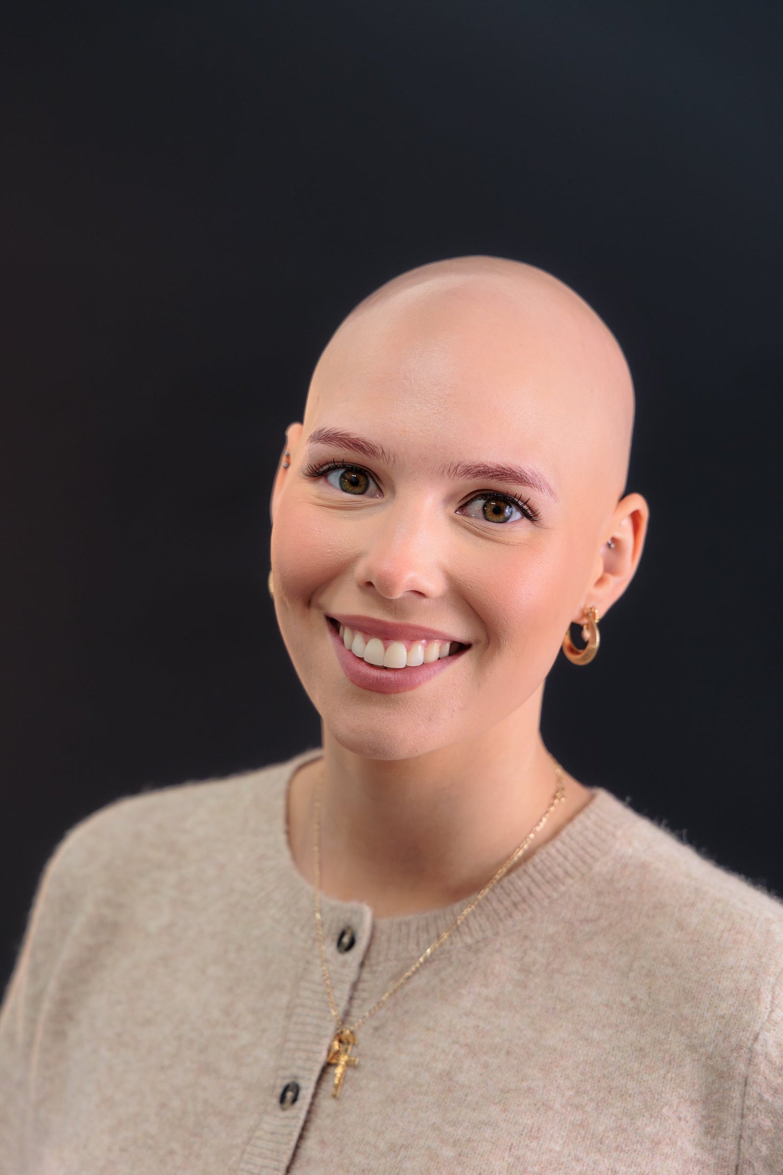 Understand Hormonal Hair Loss in Women: Causes & Solutions