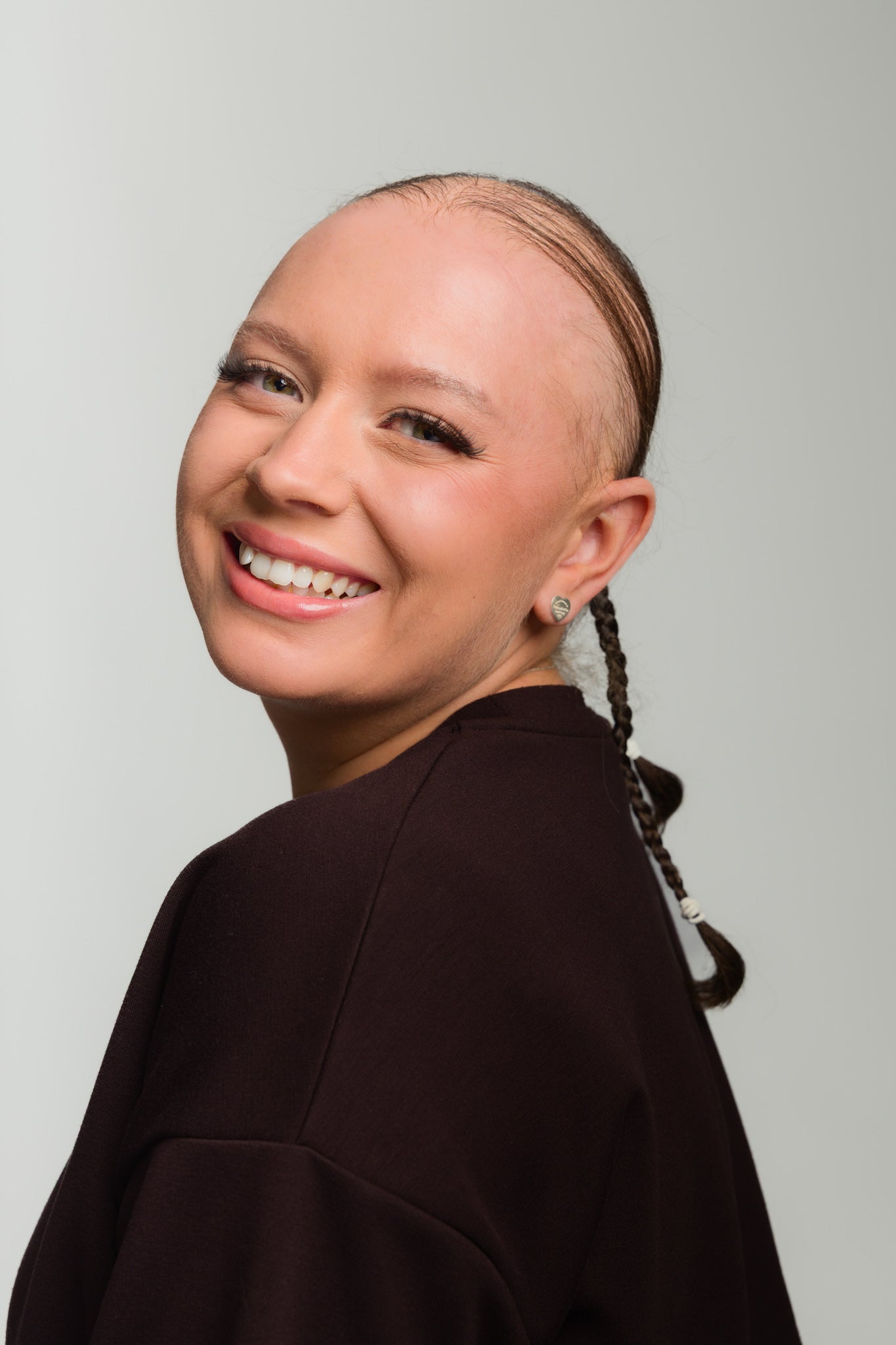 What Is Alopecia? A Complete Guide