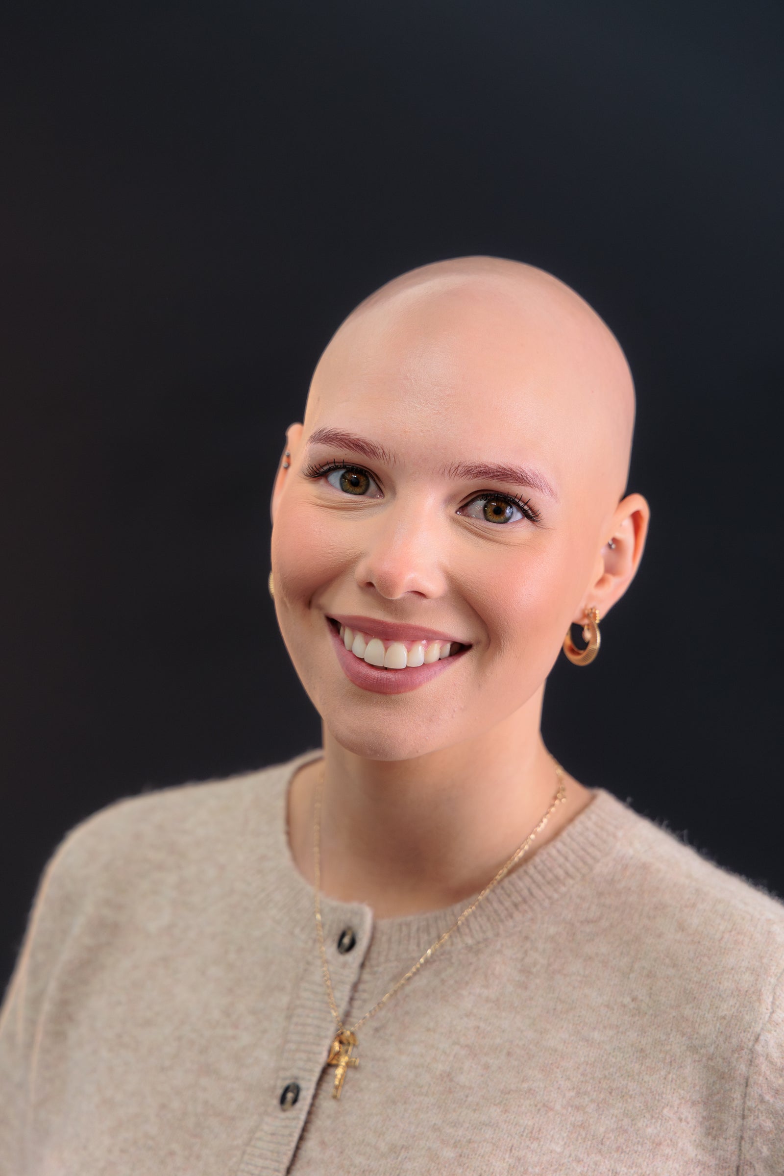 Girl with alopecia wearing a natural real human hair wig from Nuola Wigs – comfortable and stylish solutions available in the UK, USA, and Canada