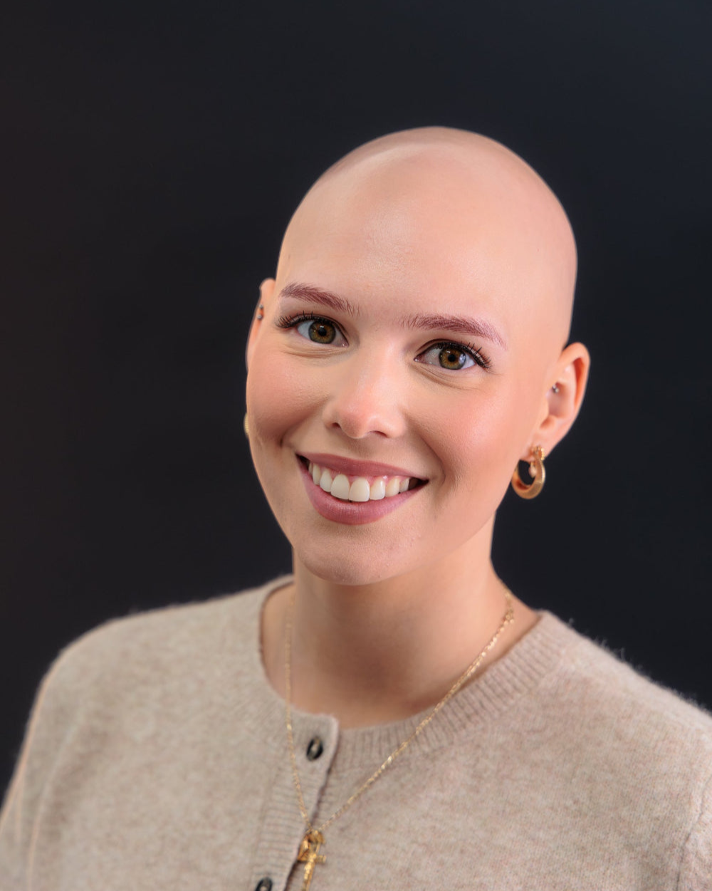 Girl with alopecia wearing a natural real human hair wig from Nuola Wigs – comfortable and stylish solutions available in the UK, USA, and Canada